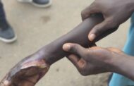 Police Officer In Akyem Oda Allegedly Burns 11-Year-Old Boy For Spending GHc2