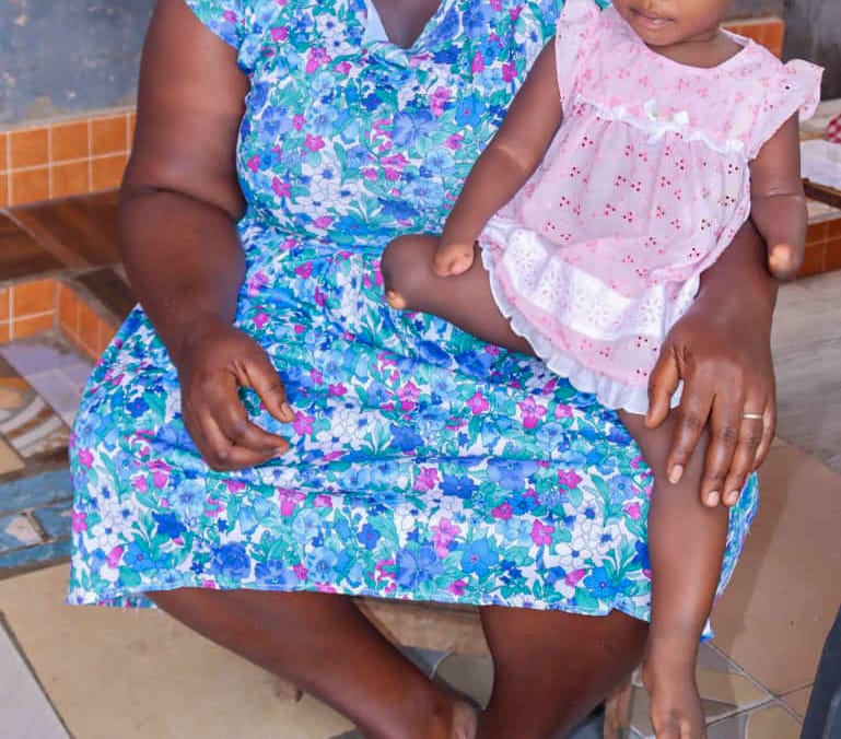 Pentecost Elder And Wife Refuse To Kill Baby Born With Phocomelia, Run To Koforidua