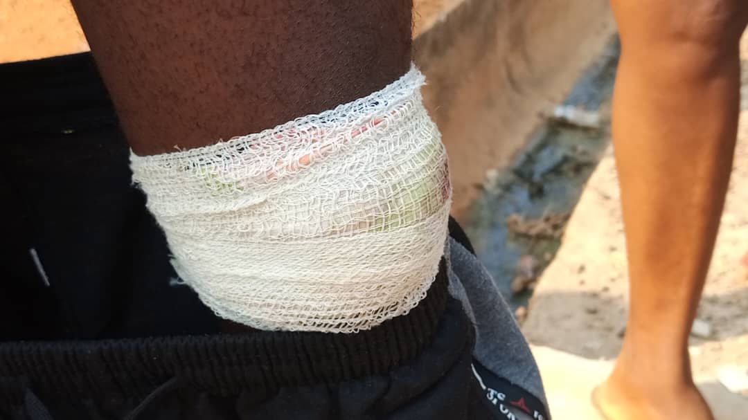E/R: Several Injured, Woman Hospitalized After Clash Between Youth And Alleged Military Personnel In Akyem Saaman
