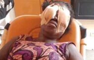 Suspect Remanded Over Stabbing Of Woman In Both Eyes; victim To Seek Treatment Abroad