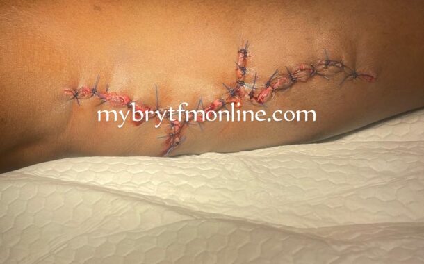 Kyebi Shooting Incident: Victim Undergoes Surgery As Youth Allege GH¢80,000 Payment To Soldiers