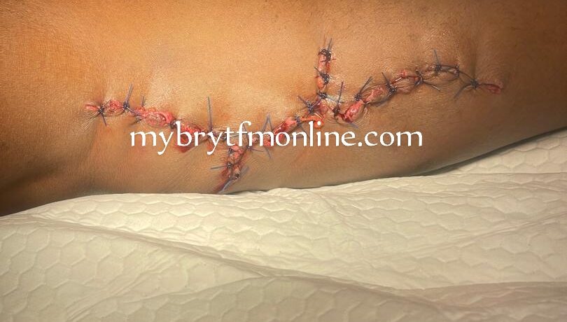 Kyebi Shooting Incident: Victim Undergoes Surgery As Youth Allege GH¢80,000 Payment To Soldiers