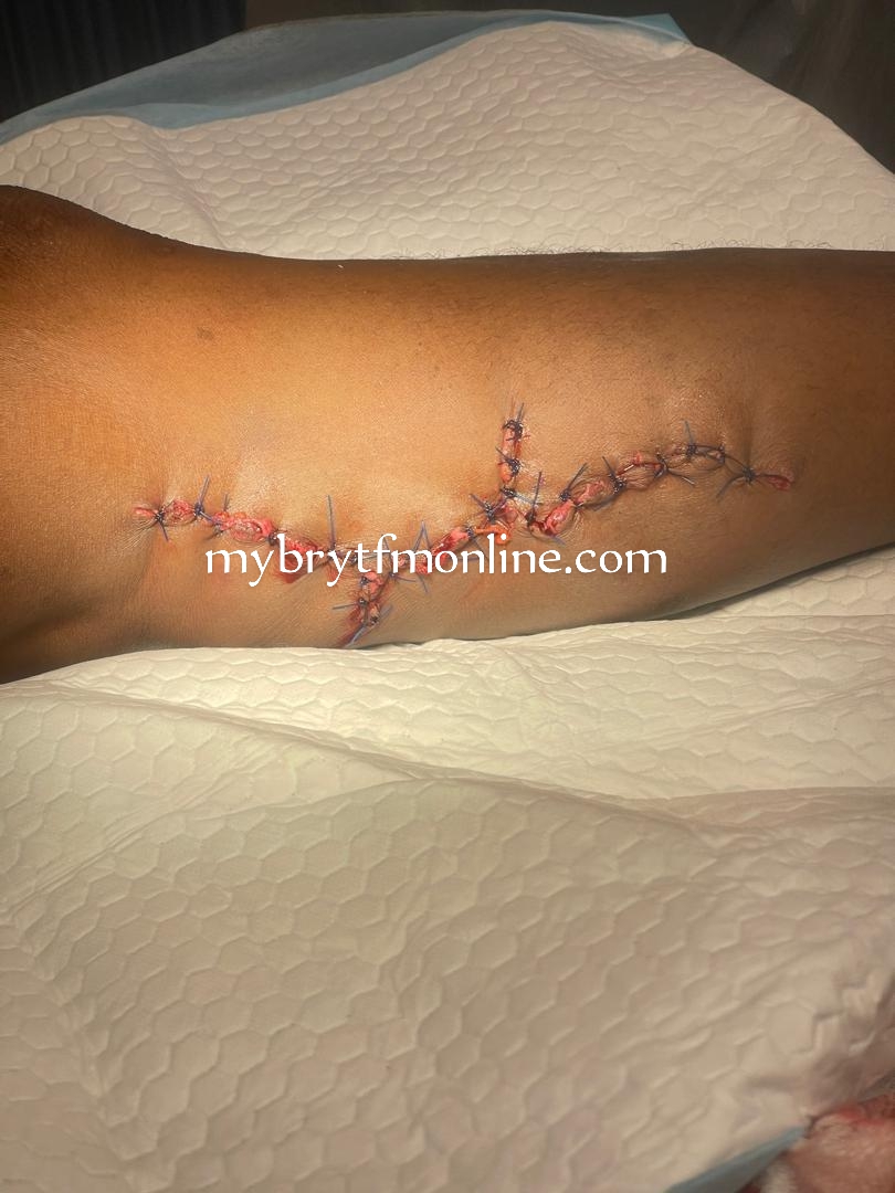 Kyebi Shooting Incident: Victim Undergoes Surgery As Youth Allege GH¢80,000 Payment To Soldiers