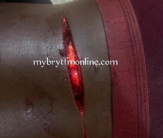 JHS Graduate Heading To SHS Attacked With Cutlass At Koforidua Pipeline