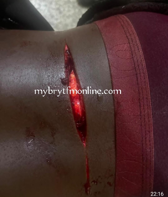 JHS Graduate Heading To SHS Attacked With Cutlass At Koforidua Pipeline